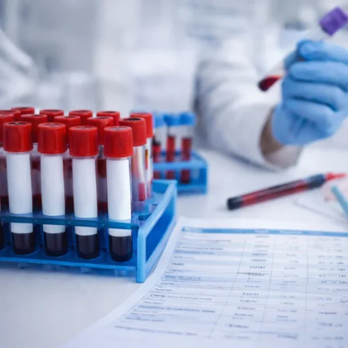 fertility-tests fertility tests